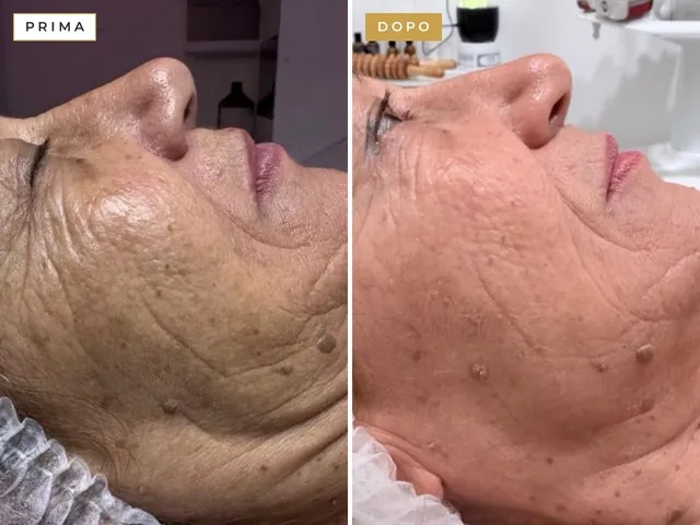Viso di una cliente prima e dopo un trattamento viso all’Oasi del Benessere